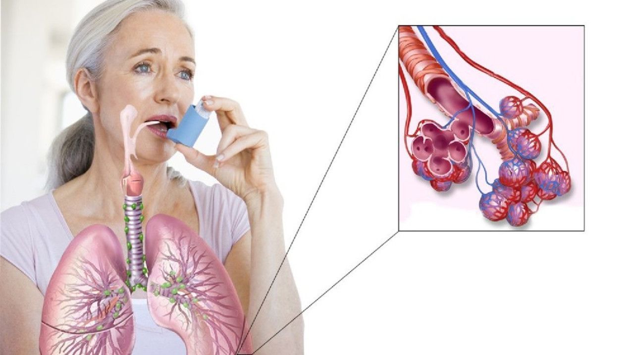 Симптомы бронхиальной астмы: