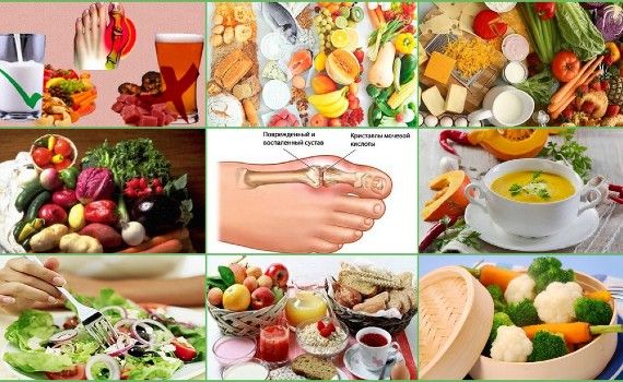 Диета при подагре таблица продуктов и рекомендации по питанию