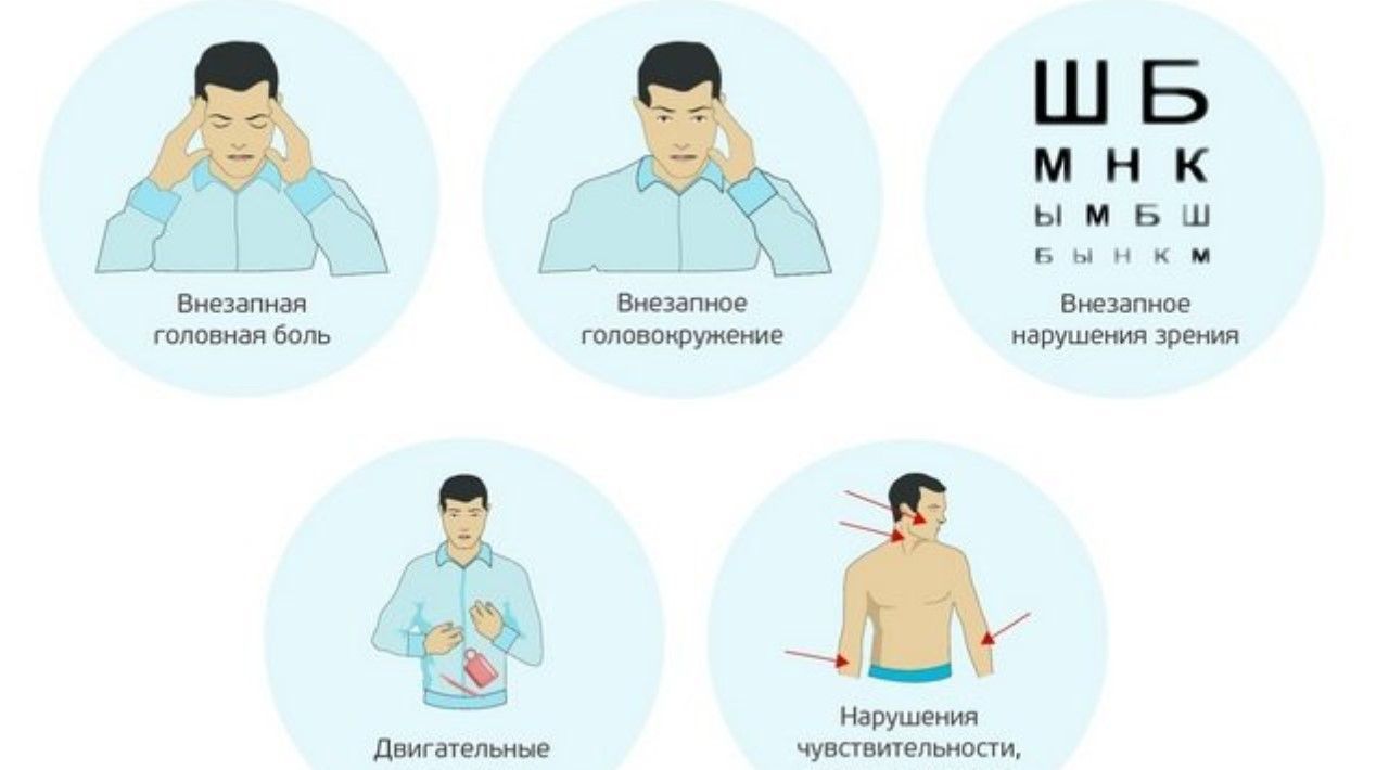 Лечение транзиторных ишемических атак в Екатеринбурге - Новая больница